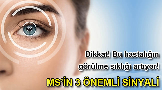 MS’İN 3 ÖNEMLİ SİNYALİ