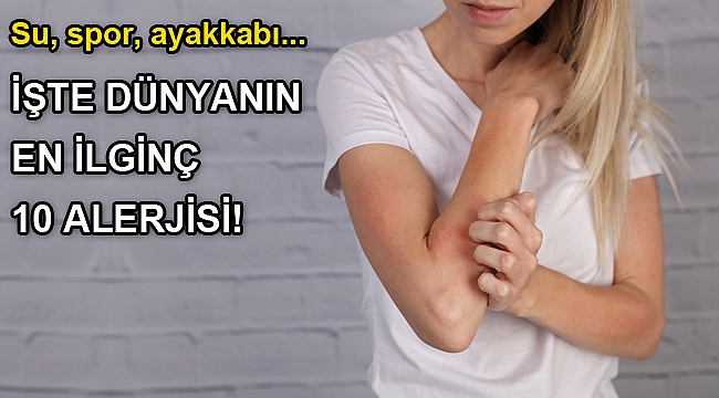 EN İLGİNÇ 10 ALERJİ