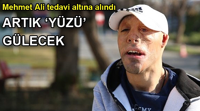 Mehmet Ali de