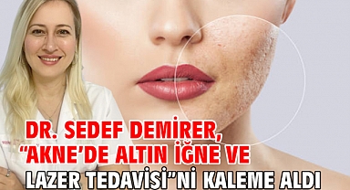 “Akne’de Altın İğne ve Lazer Tedavisi”