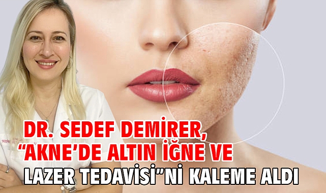 “Akne’de Altın İğne ve Lazer Tedavisi”