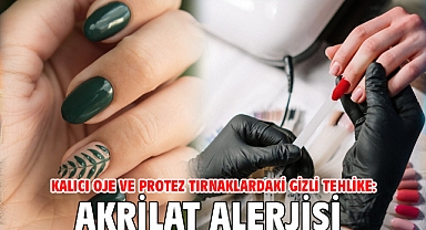 Kalıcı oje ve protez tırnaklardaki gizli tehlike: Akrilat Alerjisi