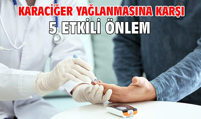 Karaciğer Yağlanmasına Karşı 5 Etkili Önlem!