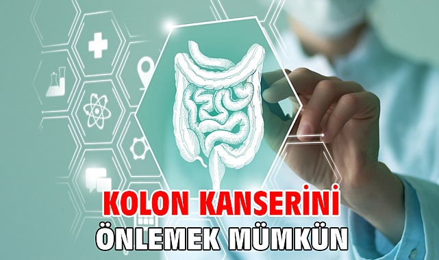KOLON KANSERİNİ ÖNLEMEK MÜMKÜN!