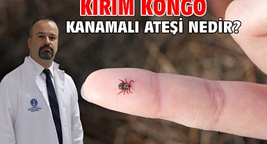Kırım Kongo Kanamalı Ateşi Nedir?