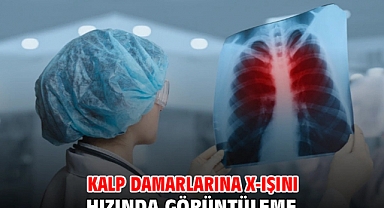 KALP DAMARLARINA X-IŞINI HIZINDA GÖRÜNTÜLEME