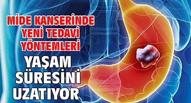 MİDE KANSERİNDE YENİ TEDAVİ YÖNTEMLERİ YAŞAM SÜRESİNİ UZATIYOR