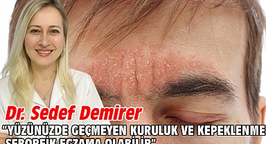 Yüzünüzde geçmeyen kuruluk ve kepeklenme seboreik egzama olabilir!