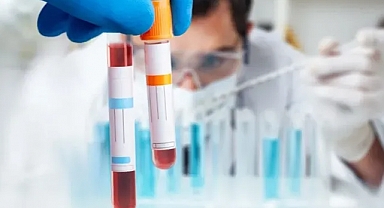 Hatırlamak için yeni umut: Bu test her şeyi değiştirebilir!