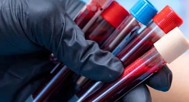 Tek tüp kanla Alzheimer teşhisi: Erken tanı artık mümkün