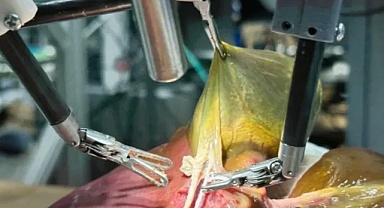 Robot cerrah sıfır hata ile ameliyat yaptı, tüm kararları kendi aldı