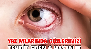 YAZ AYLARINDA GÖZLERİMİZİ TEHDİT EDEN 6 HASTALIK