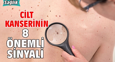 CİLT KANSERİNİN 8 ÖNEMLİ SİNYALİ!