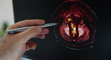 Obezite, endometrium kanseri riskini artırıyor