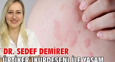 Ürtiker (Kurdeşen) ile Yaşam