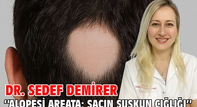 Alopesi Areata: Saçın Suskun Çığlığı