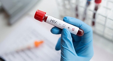 Uzmanı açıkladı: 'Türkiye'de HIV enfeksiyonunda sessiz bir pandemi var'