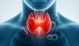 Uzmanı uyardı: ‘Subakut tiroiti gözden kaçıyor’