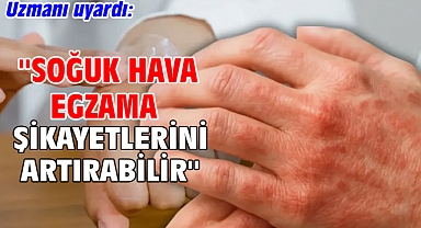 Uzmanı uyardı: ''Soğuk hava egzama şikayetlerini artırabilir''