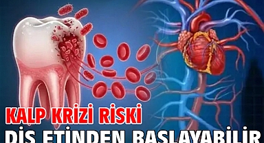 Kalp Krizi Riski Diş Etinden Başlayabilir!