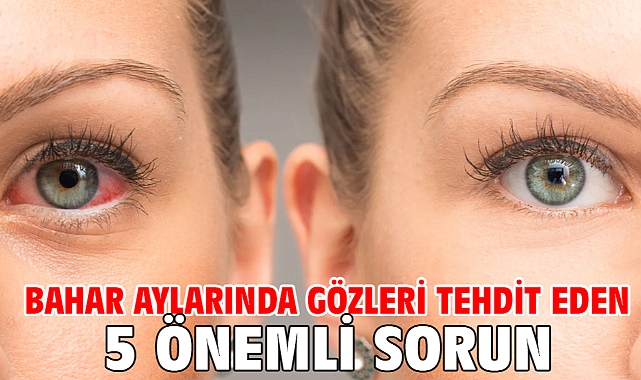 Bahar Aylarında Gözleri Tehdit Eden 5 Önemli Sorun!