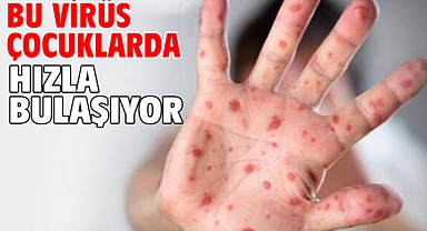Bu Virüs Çocuklarda Hızla Bulaşıyor!