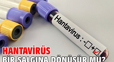  Hantavirüs Bir Salgına Dönüşür mü?