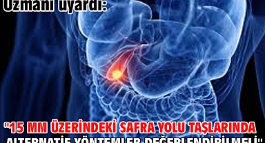  Uzmanı uyardı: 