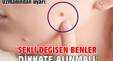 Uzmanı uyardı: 