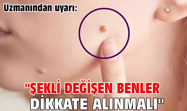Uzmanı uyardı: