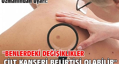 Uzmanından uyarı: 