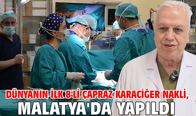 Dünyanın ilk 8'li çapraz karaciğer nakli, Malatya'da yapıldı