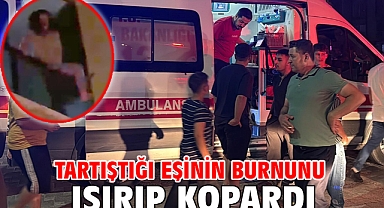 Tartıştığı eşinin burnunu ısırıp kopardı