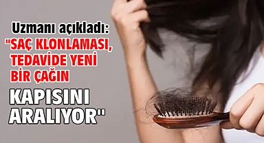 Uzmanı açıkladı: