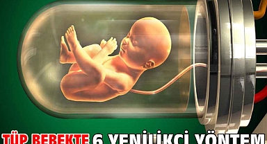 Tüp Bebekte 6 Yenilikçi Yöntem