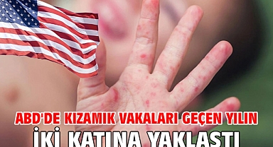 ABD'de kızamık vakaları geçen yılın iki katına yaklaştı