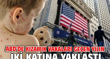 ABD'de kızamık vakaları geçen yılın iki katına yaklaştı