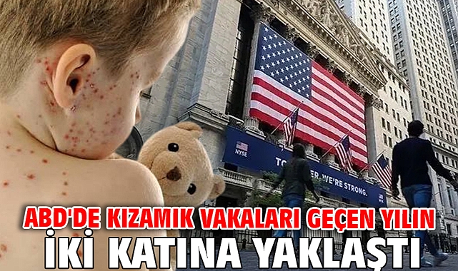 ABD'de kızamık vakaları geçen yılın iki katına yaklaştı