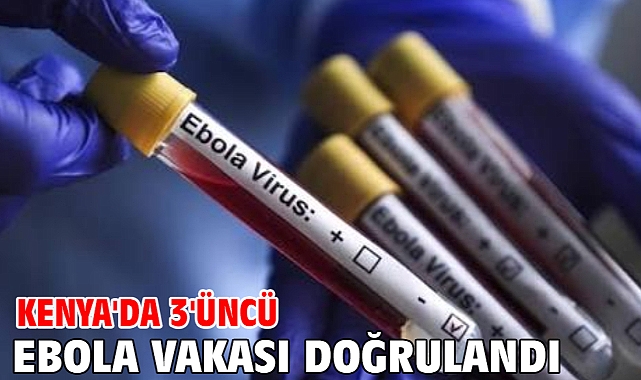 Kenya'da 3'üncü Ebola vakası doğrulandı