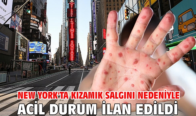 New York'ta kızamık salgını nedeniyle acil durum ilan edildi