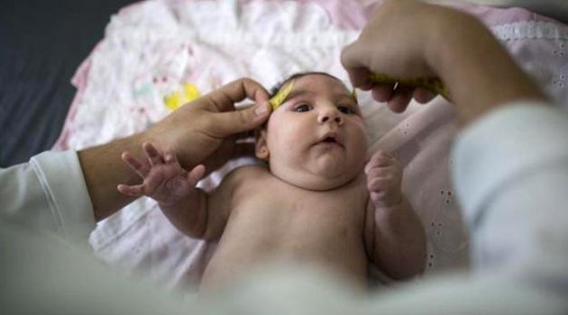 Zika virüsünün etkileri çok kötü